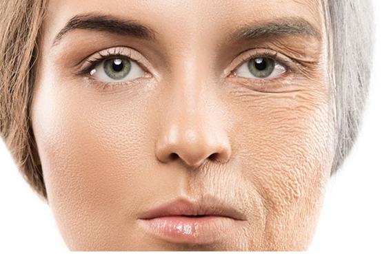 aging